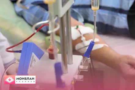 Врач проводит лечение плазмаферезом